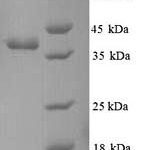 SDS-PAGE separation of QP9632 followed by commassie total protein stain results in a primary band consistent with reported data for Methyl-accepting chemotaxis protein I. These data demonstrate Greater than 90% as determined by SDS-PAGE.