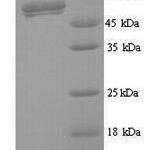 SDS-PAGE separation of QP9634 followed by commassie total protein stain results in a primary band consistent with reported data for Fusion glycoprotein F0. These data demonstrate Greater than 90% as determined by SDS-PAGE.