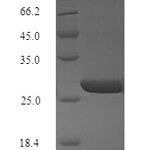 SDS-PAGE separation of QP9635 followed by commassie total protein stain results in a primary band consistent with reported data for Influenza A H3N2 (strain A / Bangkok / 1 / 1979) Hemagglutinin. These data demonstrate Greater than 90% as determined by SDS-PAGE.