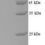 SDS-PAGE separation of QP9684 followed by commassie total protein stain results in a primary band consistent with reported data for Low molecular weight antigen MTB12. These data demonstrate Greater than 90% as determined by SDS-PAGE.