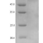 SDS-PAGE separation of QP9752 followed by commassie total protein stain results in a primary band consistent with reported data for UDP-N-acetylhexosamine pyrophosphorylase. These data demonstrate Greater than 90% as determined by SDS-PAGE.