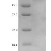 SDS-PAGE separation of QP9752 followed by commassie total protein stain results in a primary band consistent with reported data for UDP-N-acetylhexosamine pyrophosphorylase. These data demonstrate Greater than 90% as determined by SDS-PAGE.