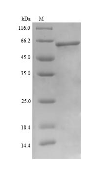 SDS-PAGE separation of QP9752 followed by commassie total protein stain results in a primary band consistent with reported data for UDP-N-acetylhexosamine pyrophosphorylase. These data demonstrate Greater than 90% as determined by SDS-PAGE.