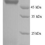 SDS-PAGE separation of QP9753 followed by commassie total protein stain results in a primary band consistent with reported data for Hyaluronidase-2. These data demonstrate Greater than 90% as determined by SDS-PAGE.