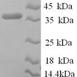 SDS-PAGE separation of QP9756 followed by commassie total protein stain results in a primary band consistent with reported data for Reticulocalbin-1. These data demonstrate Greater than 90% as determined by SDS-PAGE.