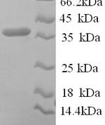 SDS-PAGE separation of QP9756 followed by commassie total protein stain results in a primary band consistent with reported data for Reticulocalbin-1. These data demonstrate Greater than 90% as determined by SDS-PAGE.