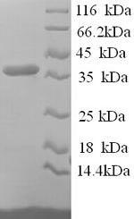 SDS-PAGE separation of QP9756 followed by commassie total protein stain results in a primary band consistent with reported data for Reticulocalbin-1. These data demonstrate Greater than 90% as determined by SDS-PAGE.