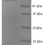 SDS-PAGE separation of QP9763 followed by commassie total protein stain results in a primary band consistent with reported data for Inactive tyrosine-protein kinase 7. These data demonstrate Greater than 90% as determined by SDS-PAGE.