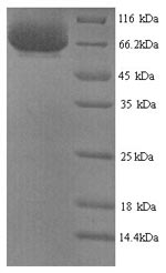 SDS-PAGE separation of QP9763 followed by commassie total protein stain results in a primary band consistent with reported data for Inactive tyrosine-protein kinase 7. These data demonstrate Greater than 90% as determined by SDS-PAGE.