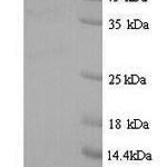 SDS-PAGE separation of QP9814 followed by commassie total protein stain results in a primary band consistent with reported data for GIGYF2. These data demonstrate Greater than 90% as determined by SDS-PAGE.