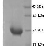 SDS-PAGE separation of QP9818 followed by commassie total protein stain results in a primary band consistent with reported data for Butyrophilin subfamily 2 member A1. These data demonstrate Greater than 90% as determined by SDS-PAGE.