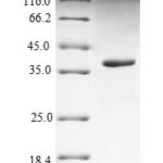 SDS-PAGE separation of QP9847 followed by commassie total protein stain results in a primary band consistent with reported data for Nectin-4. These data demonstrate Greater than 90% as determined by SDS-PAGE.