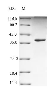 SDS-PAGE separation of QP9847 followed by commassie total protein stain results in a primary band consistent with reported data for Nectin-4. These data demonstrate Greater than 90% as determined by SDS-PAGE.