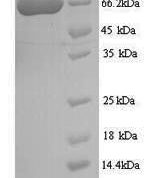 SDS-PAGE separation of QP9861 followed by commassie total protein stain results in a primary band consistent with reported data for Twinkle protein