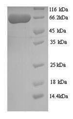 SDS-PAGE separation of QP9861 followed by commassie total protein stain results in a primary band consistent with reported data for Twinkle protein