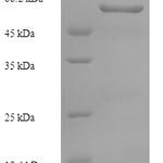 SDS-PAGE separation of QP9870 followed by commassie total protein stain results in a primary band consistent with reported data for Pseudokinase FAM20A. These data demonstrate Greater than 90% as determined by SDS-PAGE.