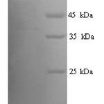 SDS-PAGE separation of QP9873 followed by commassie total protein stain results in a primary band consistent with reported data for Ptprn2. These data demonstrate Greater than 90% as determined by SDS-PAGE.