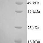 SDS-PAGE separation of QP9881 followed by commassie total protein stain results in a primary band consistent with reported data for IL12RB2 / IL12R-beta 2. These data demonstrate Greater than 90% as determined by SDS-PAGE.