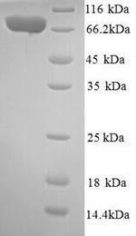 SDS-PAGE separation of QP9881 followed by commassie total protein stain results in a primary band consistent with reported data for IL12RB2 / IL12R-beta 2. These data demonstrate Greater than 90% as determined by SDS-PAGE.
