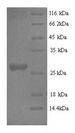 SDS-PAGE separation of QP9889 followed by commassie total protein stain results in a primary band consistent with reported data for IL6 / Interleukin-6 Protein. These data demonstrate Greater than 90% as determined by SDS-PAGE.