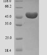 SDS-PAGE separation of QP9909 followed by commassie total protein stain results in a primary band consistent with reported data for Ameloblastin. These data demonstrate Greater than 90% as determined by SDS-PAGE.