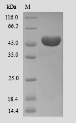 SDS-PAGE separation of QP9909 followed by commassie total protein stain results in a primary band consistent with reported data for Ameloblastin. These data demonstrate Greater than 90% as determined by SDS-PAGE.