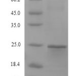 SDS-PAGE separation of QP9916 followed by commassie total protein stain results in a primary band consistent with reported data for Stromal cell-derived factor 2-like protein 1. These data demonstrate Greater than 90% as determined by SDS-PAGE.