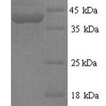 SDS-PAGE separation of QP9918 followed by commassie total protein stain results in a primary band consistent with reported data for Protein flightless-1 homolog. These data demonstrate Greater than 90% as determined by SDS-PAGE.