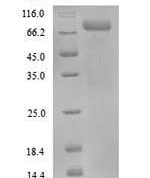 SDS-PAGE separation of QP9930 followed by commassie total protein stain results in a primary band consistent with reported data for Protein-arginine deiminase type-3. These data demonstrate Greater than 90% as determined by SDS-PAGE.