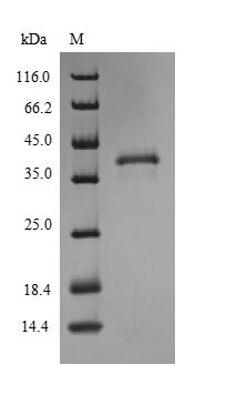 SDS-PAGE separation of QP9957 followed by commassie total protein stain results in a primary band consistent with reported data for High affinity copper uptake protein 1. These data demonstrate Greater than 85% as determined by SDS-PAGE.