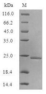 SDS-PAGE separation of QP9963 followed by commassie total protein stain results in a primary band consistent with reported data for Aquaporin Z. These data demonstrate Greater than 85% as determined by SDS-PAGE.