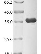 SDS PAGE image for recombinant human CDK1 demonstrating MW and purity.