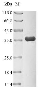 SDS PAGE image for recombinant human CDK1 demonstrating MW and purity.