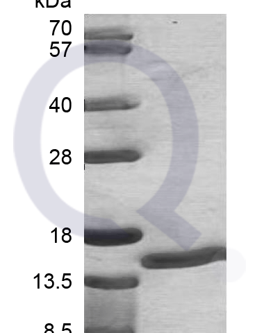 Recombinant Human S100A7 SDS-PAGE (3 ug)