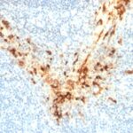 Formalin-fixed, paraffin-embedded human Tonsil stained with Mesothelin Mouse Monoclonal Antibody (MSLN/2131).