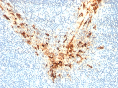 Formalin-fixed, paraffin-embedded human Tonsil stained with Mesothelin Mouse Monoclonal Antibody (MSLN/2131).