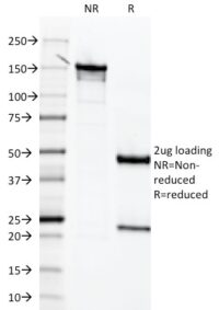 SDS-PAGE Analysis Purified Mesothelin Mouse Monoclonal Antibody (MSLN/2131).Confirmation of Integrity and Purity of the Antibody.