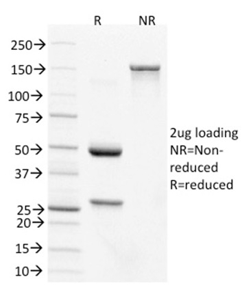 SDS-PAGE Analysis Purified CDX2 Mouse Monoclonal Antibody (PCRP-CDX2-1A3).Confirmation of Purity and Integrity of Antibody.