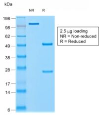 SDS-PAGE Analysis Purified Chromogranin A Mouse Recombinant Monoclonal Ab (rCHGA/798).Confirmation of Purity and Integrity of Antibody.