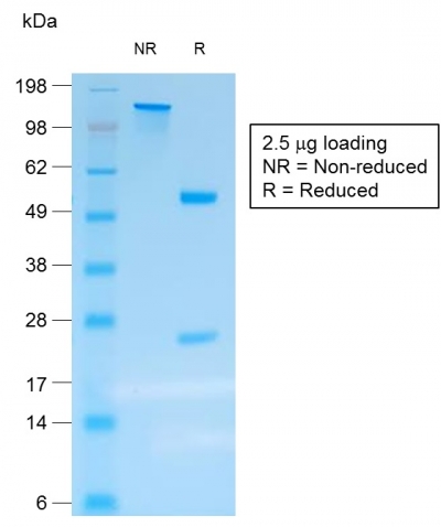 SDS-PAGE Analysis Purified Chromogranin A Mouse Recombinant Monoclonal Ab(rCHGA/413).Confirmation of Purity and Integrity of Antibody.