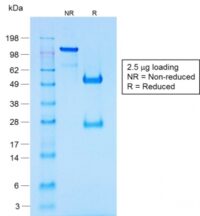 SDS-PAGE Analysis of Purified Chromogranin A Rabbit Recombinant Monoclonal Antib (CHGA/1731R).Confirmation of Purity and Integrity.