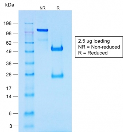 SDS-PAGE Analysis of Purified Chromogranin A Rabbit Recombinant Monoclonal Antib (CHGA/1731R).Confirmation of Purity and Integrity.