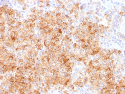 Formalin-fixed, paraffin-embedded human Parathyroid stained with Chromogranin A Rabbit Recombinant Monoclonal Ab (CHGA/1731R).