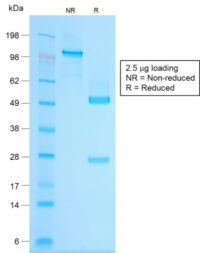 SDS-PAGE Analysis Purified Chromogranin A Rabbit Recombinant Monoclonal Antibody (CHGA/1815R).