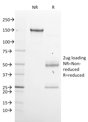 SDS-PAGE Analysis Purified GPN1 Mouse Monoclonal Antibody (GPN1/2350).Confirmation of Purity and Integrity of Antibody.