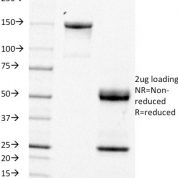 SDS-PAGE Analysis Purified CD21 / CR2 Mouse Monoclonal Antibody (CR2/1953).Confirmation of Integrity and Purity of Antibody.
