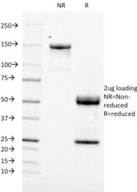 SDS-PAGE Analysis Purified CD21 / CR2 Mouse Monoclonal Antibody (CR2/1953).Confirmation of Integrity and Purity of Antibody.