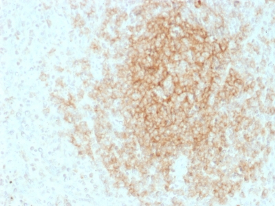 Formalin-fixed, paraffin-embedded Human Tonsil stained with CD21 / CR2 Mouse Monoclonal Antibody (CR2/1953).