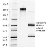 SDS-PAGE Analysis Purified EGFR Mouse Monoclonal Antibody (GFR/2341).Confirmation of Integrity and Purity of Antibody.