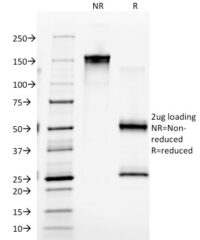 SDS-PAGE Analysis Purified EGFR Mouse Monoclonal Antibody (GFR/2341).Confirmation of Integrity and Purity of Antibody.